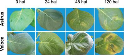 Proteomic Analysis and Functional Validation of a Brassica oleracea Endochitinase Involved in Resistance to Xanthomonas campestris
